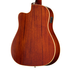 Epiphone J-45 Standard EC Honey Burst Acoustic Guitar