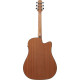 Ibanez AAD51LCE Dark Violin Sunburst High Gloss Acoustic Guitar